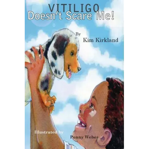 Vitiligo Doesn't Scare Me